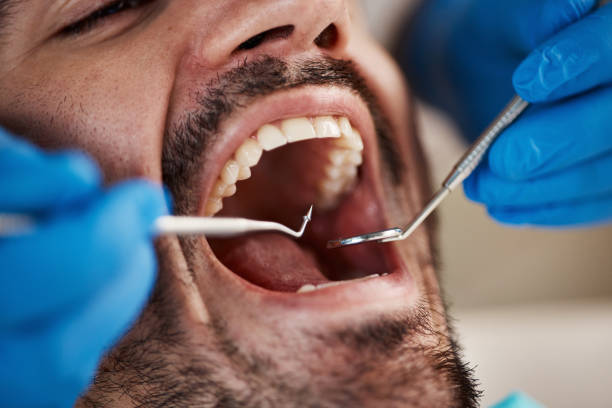 Best Same-Day Emergency Dental Services in Eden, TX